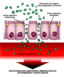 Esquema_permeabilidad_intestinal_aumentada